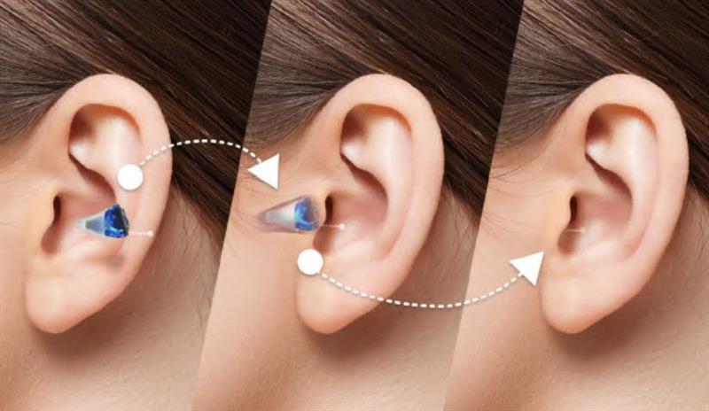 The advantages and disadvantages of in-the-ear hearing aids