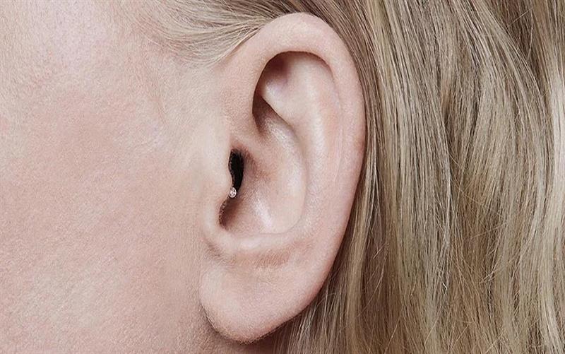 Invisible-in-the-Canal Hearing Aids: Who Can Benefit from Them?