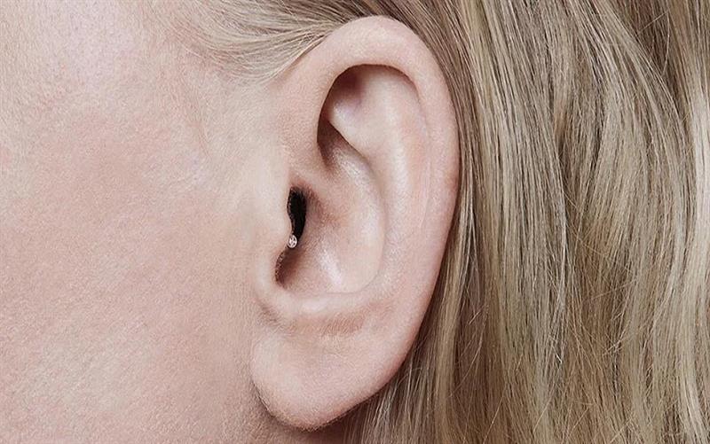 Invisible-in-the-Canal Hearing Aids: Revolutionizing Hearing Technology